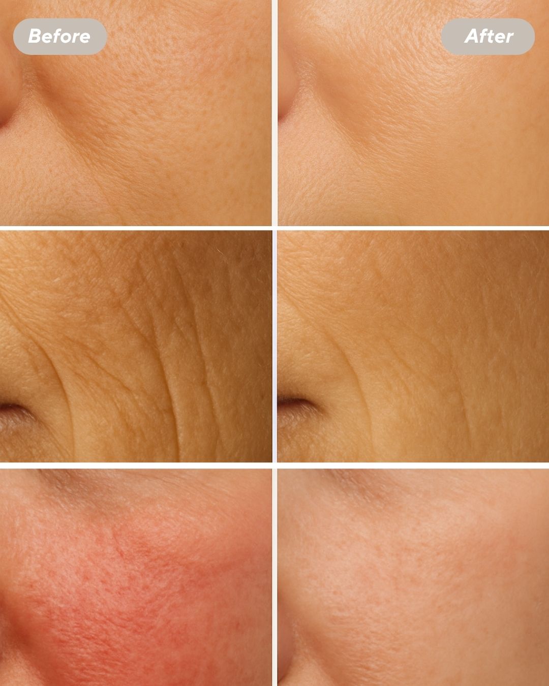 Mavèa – Red Light Therapy Mask